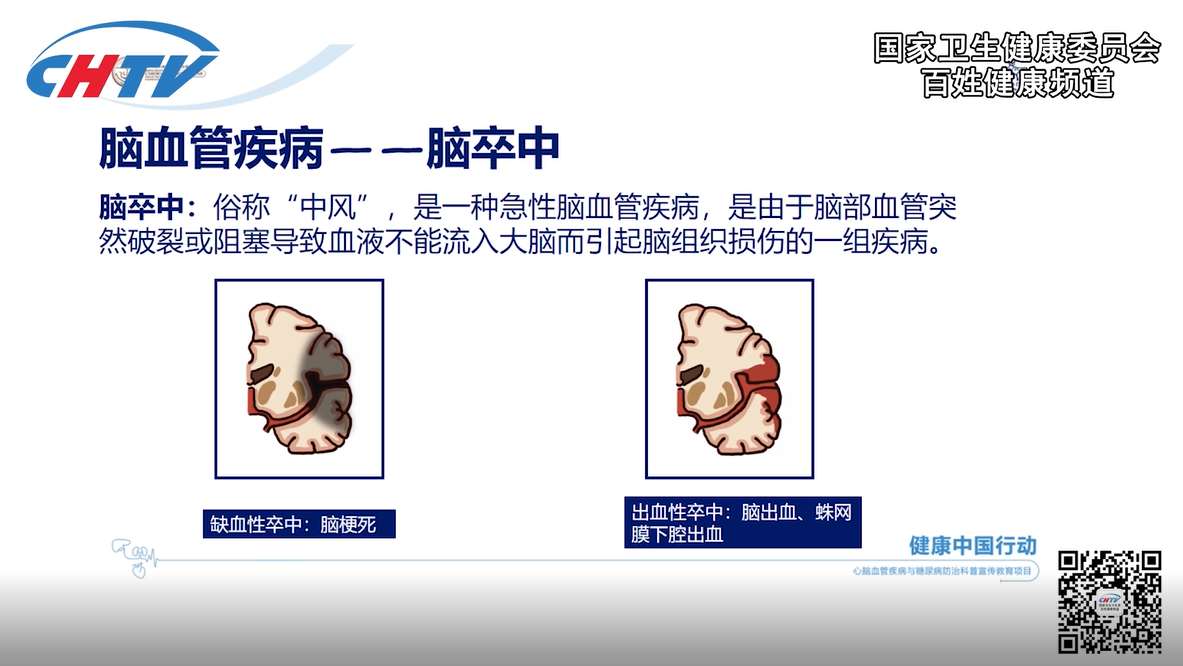 中风会导致严重后果吗？